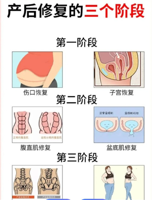 剖腹产和顺产改善有区别吗?不同分娩方式的专属改善指南