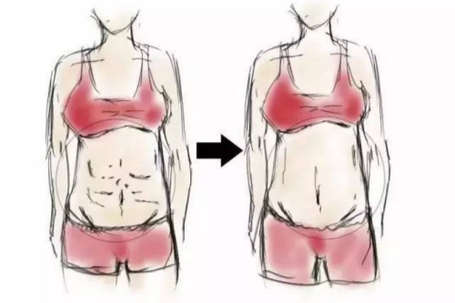 生完孩子多久能做腹部整形?医师揭秘更佳时间,助你快速修养孕前身材!