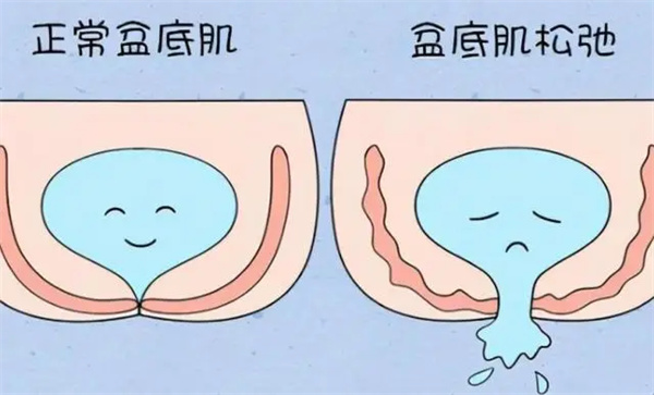 做产后修复一般价格是多少?不同项目收费价格不等!